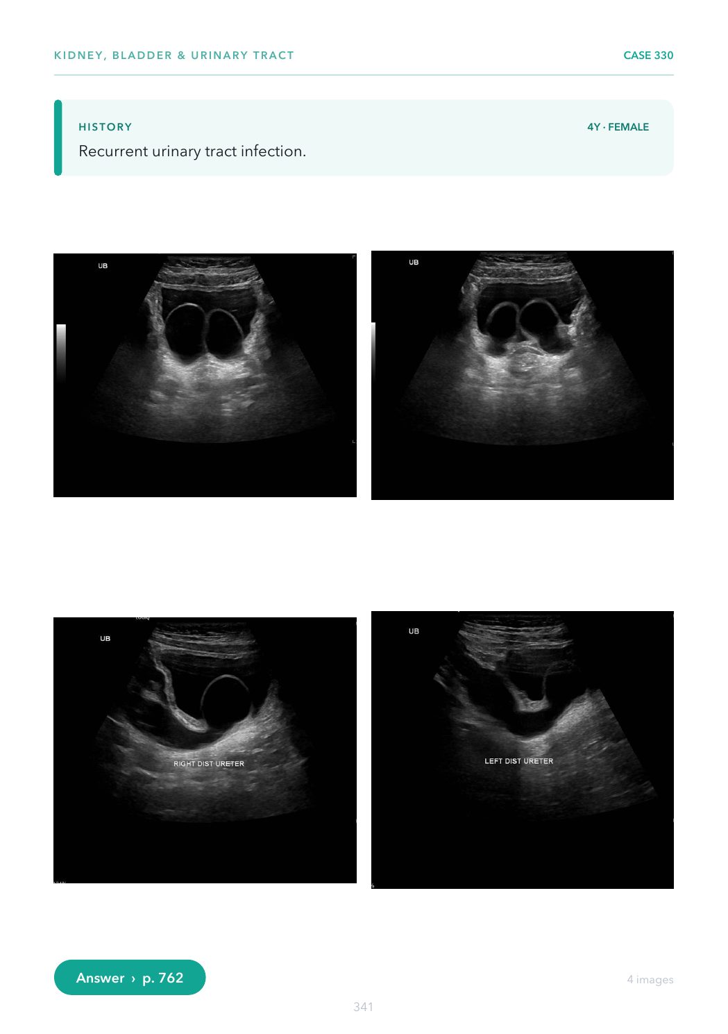 A Case Page from the Ultrasound Casebook