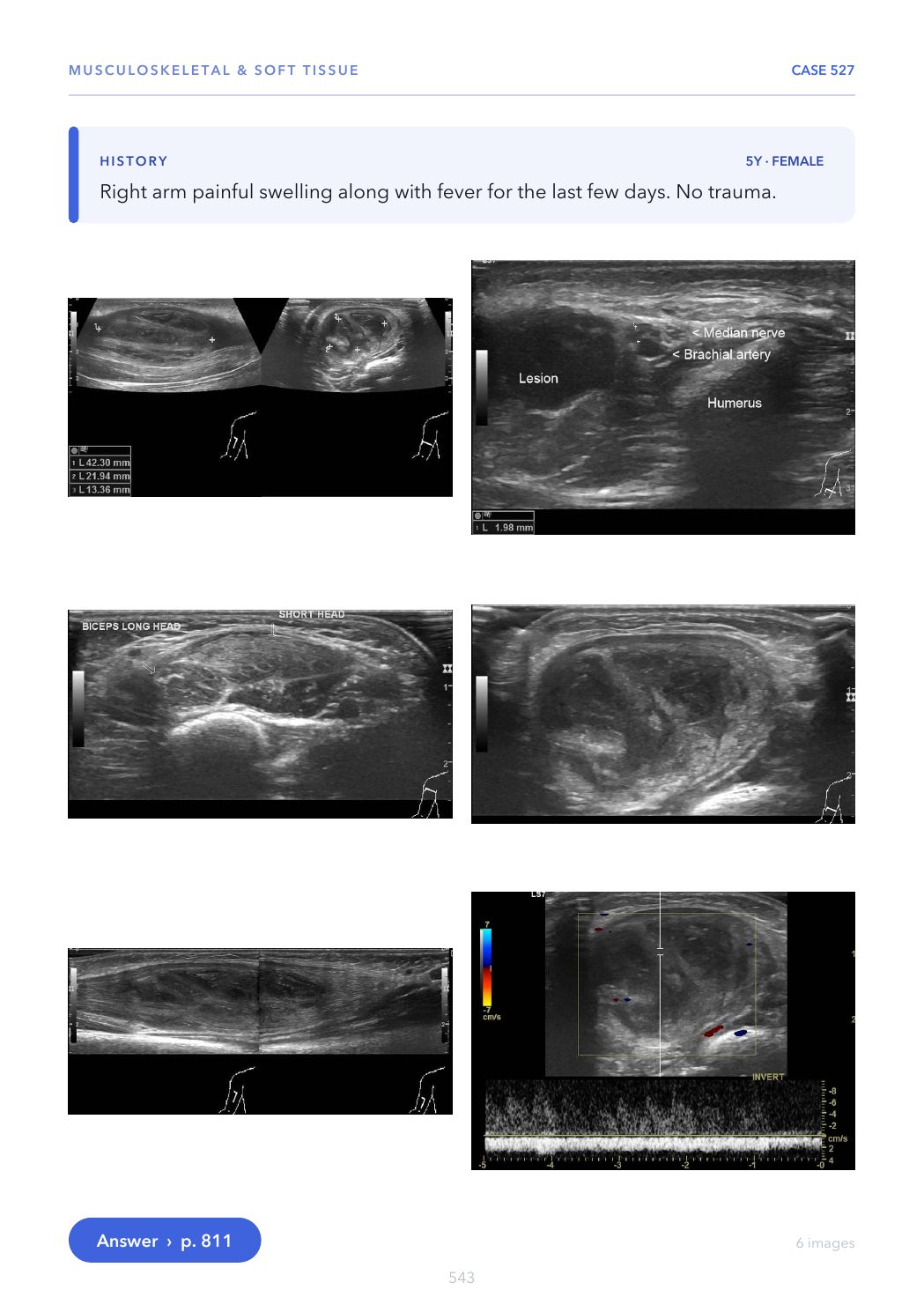 Sampled Cine Loop from the Ultrasound Casebook