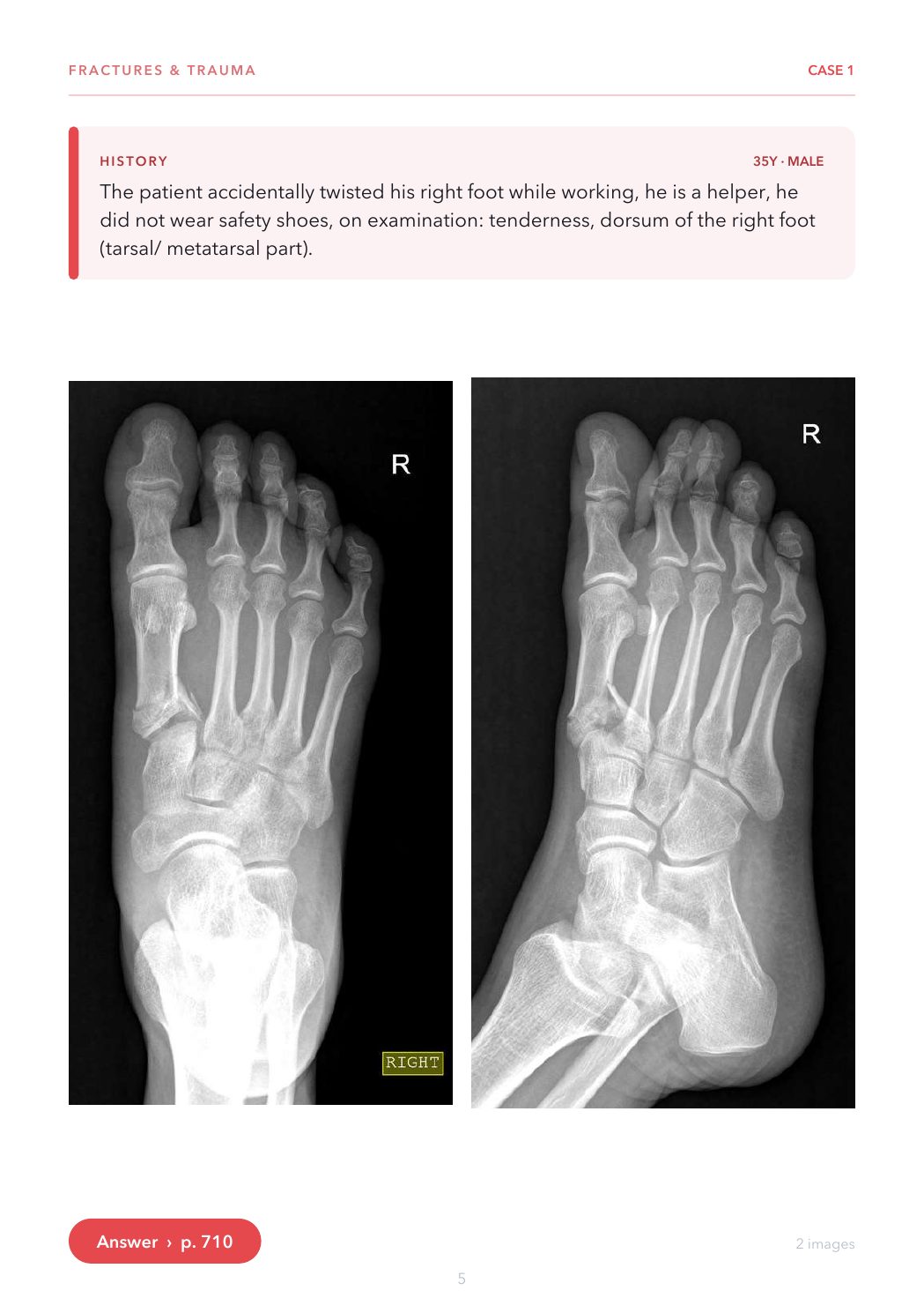 A Case Page from the X-ray Casebook