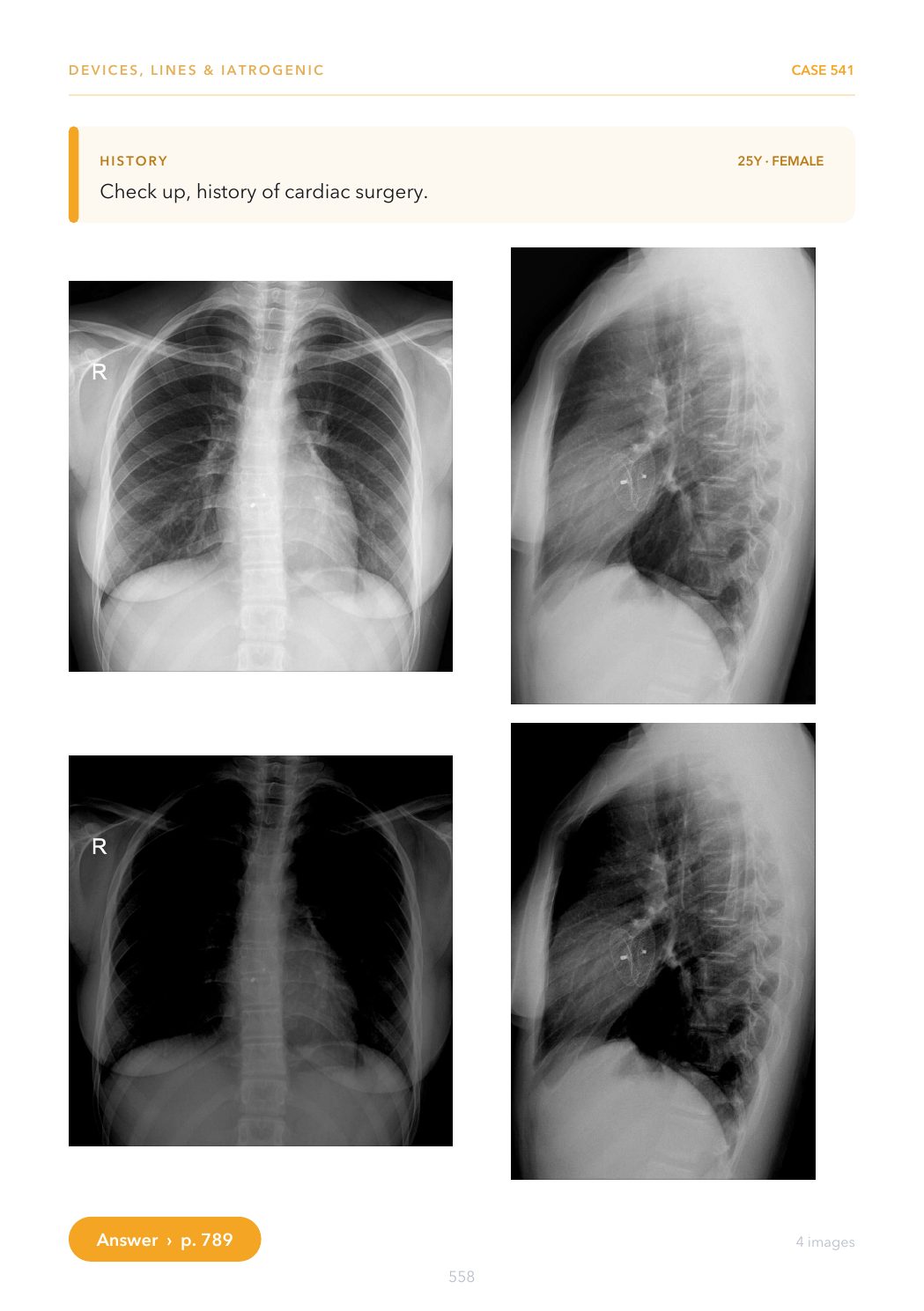 Multi-view Case from the X-ray Casebook